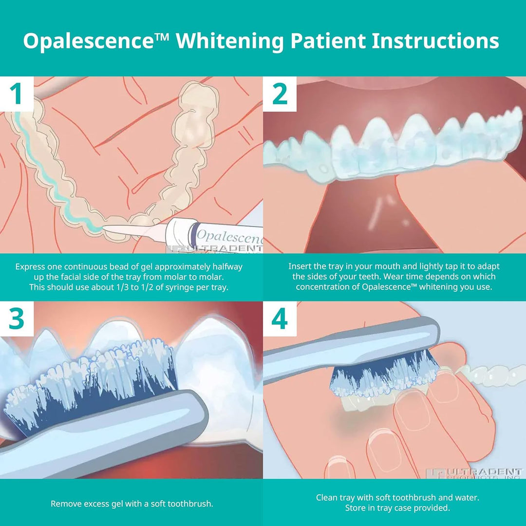 Seringues en gel Opalescence pour le blanchiment des dents - Kit de recharge (2 paquets / 4 seringues au total) Peroxyde de carbamide. Fabriqué par Ultradent, au goût de menthe. Seringues de recharge pour blanchiment des dents 